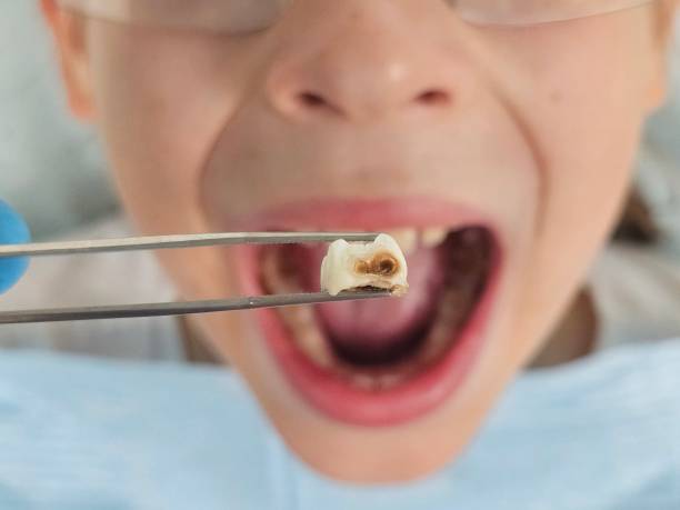 Professional Emergency Dentist in SC